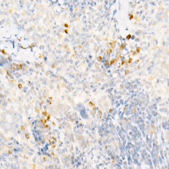 CCL2/MCP-1 Rabbit pAb