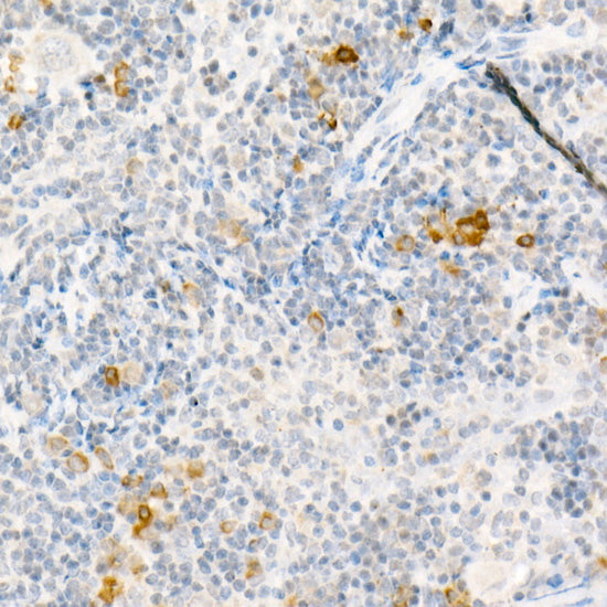 CCL2/MCP-1 Rabbit pAb