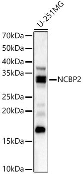 NCBP2 Rabbit pAb