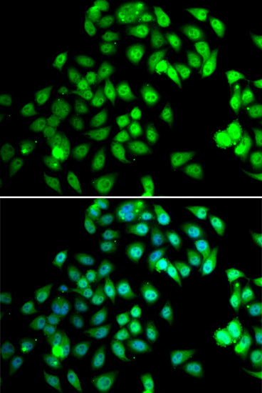 NCBP2 Rabbit pAb