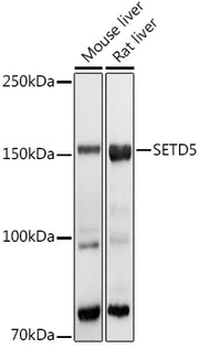 SETD5 Rabbit pAb