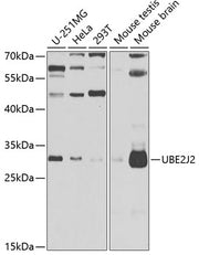 UBE2J2 Rabbit pAb