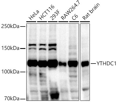 YTHDC1 Rabbit pAb