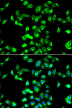 Kallistatin (SERPINA4) Rabbit pAb