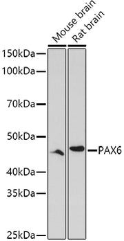 PAX6 Rabbit pAb