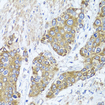 PEX14 Rabbit pAb