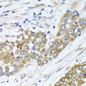 PEX14 Rabbit pAb