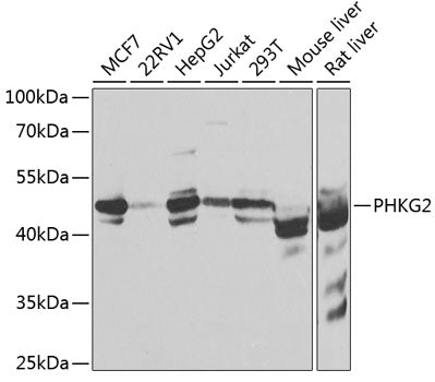 PHKG2 Rabbit pAb