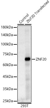 ZNF20 Rabbit pAb