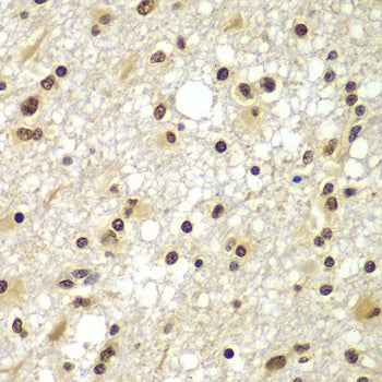 ZNF20 Rabbit pAb