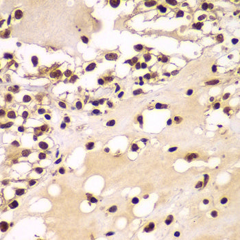 ZNF20 Rabbit pAb