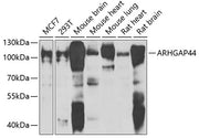 ARHGAP44 Rabbit pAb