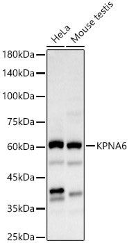 KPNA6 Rabbit pAb