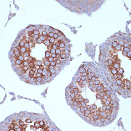 KIF3A Rabbit mAb