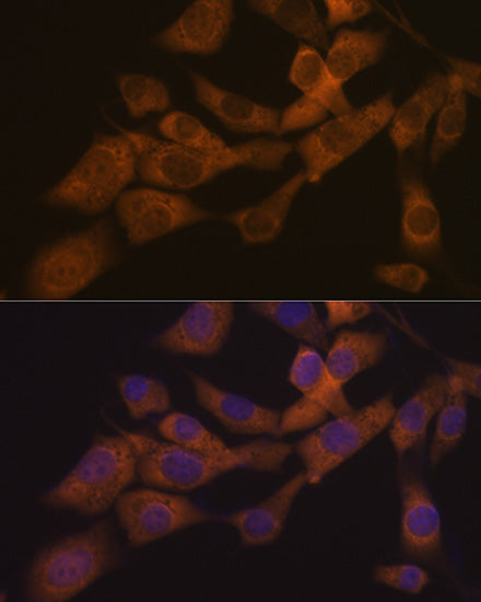KIF3A Rabbit mAb