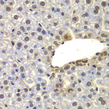 SUPT20H Rabbit pAb