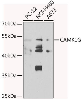 CAMK1G Rabbit pAb