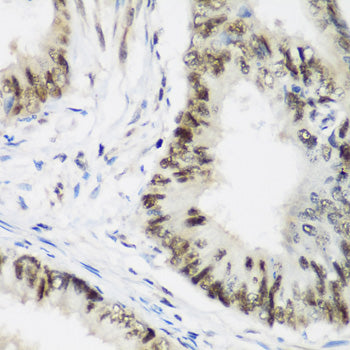 AEBP2 Rabbit pAb