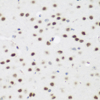 AEBP2 Rabbit pAb