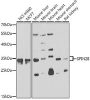 SPIN2B Rabbit pAb