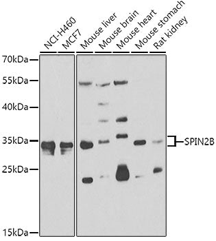 SPIN2B Rabbit pAb