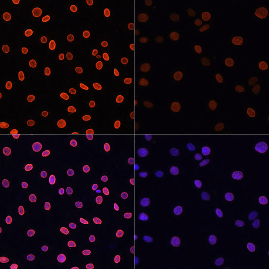 Acetyl-Histone H4-K91 Rabbit pAb