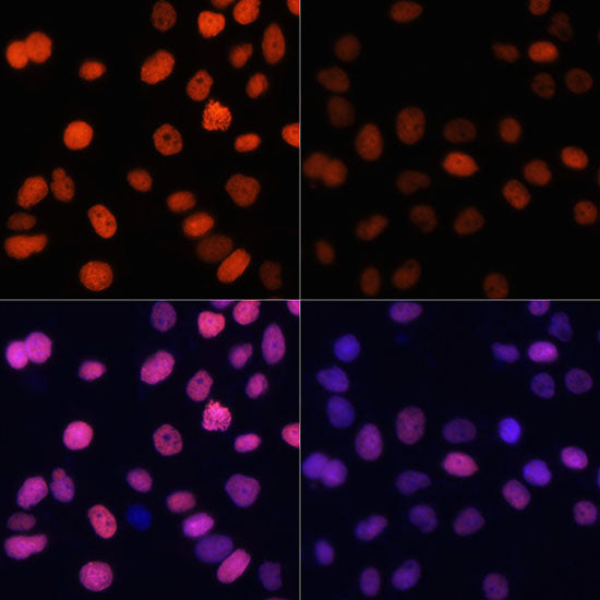Acetyl-Histone H4-K91 Rabbit pAb