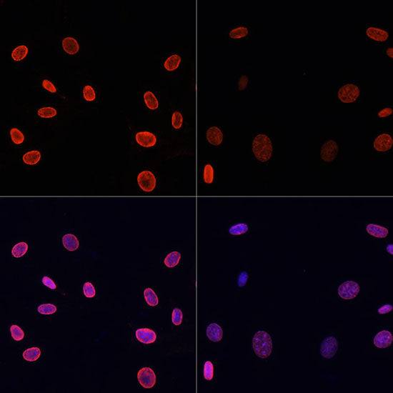 Acetyl-Histone H4-K91 Rabbit pAb