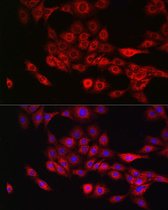 Annexin A11  Rabbit pAb