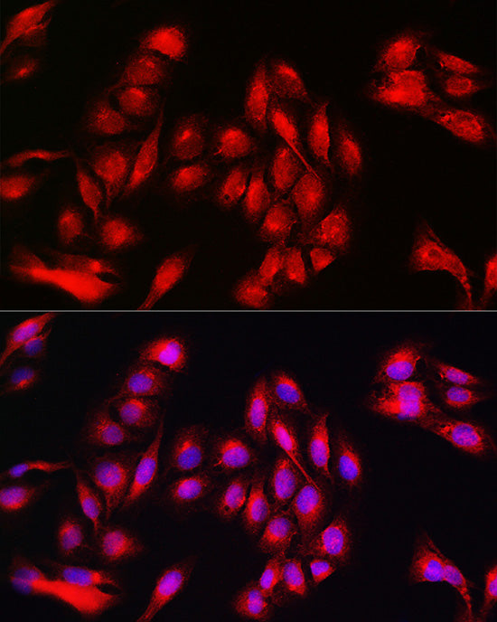 Annexin A11  Rabbit pAb