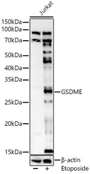 GSDME (Full length+N terminal)Rabbit pAb
