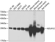 NDUFV2 Rabbit pAb