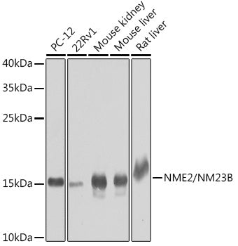 NME2/NM23B Rabbit pAb