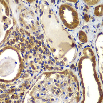 NME2/NM23B Rabbit pAb