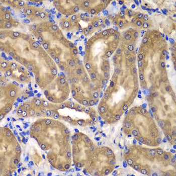 NME2/NM23B Rabbit pAb