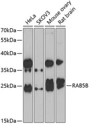 RAB5B Rabbit pAb
