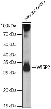 WISP2 Rabbit pAb