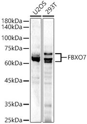 FBXO7 Rabbit pAb
