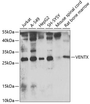 VENTX Rabbit pAb