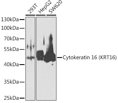 Cytokeratin 16 (KRT16) Rabbit pAb