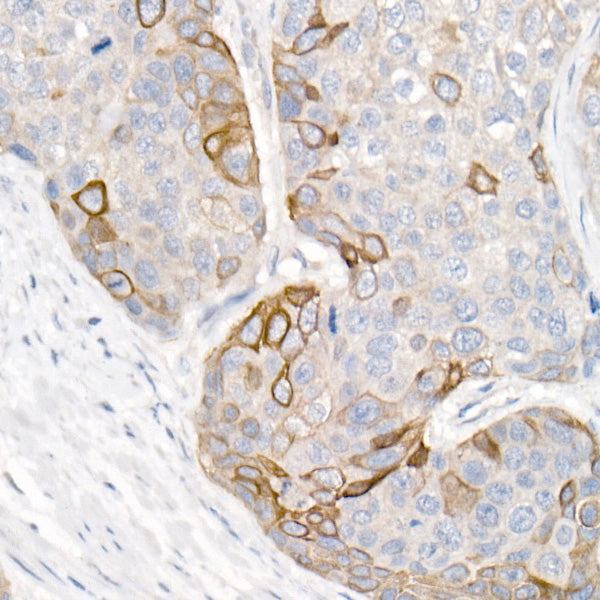 Cytokeratin 16 (KRT16) Rabbit pAb