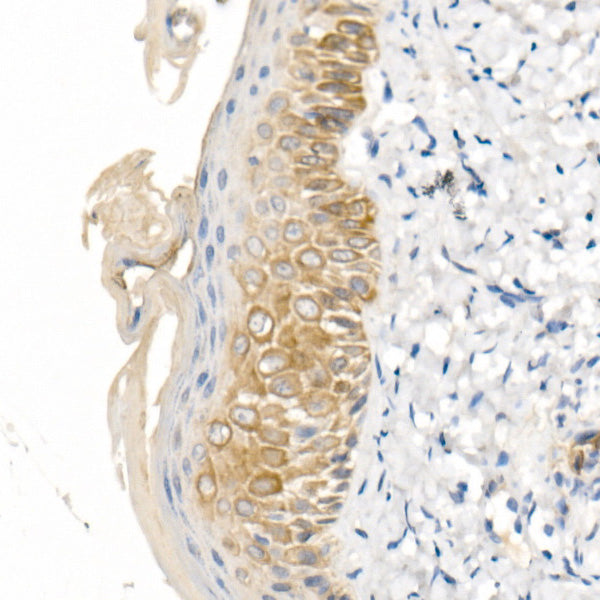Cytokeratin 16 (KRT16) Rabbit pAb