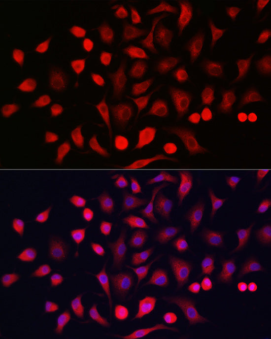 Cytokeratin 16 (KRT16) Rabbit pAb
