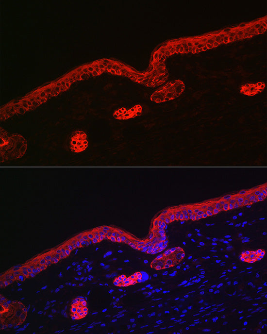 Cytokeratin 16 (KRT16) Rabbit pAb