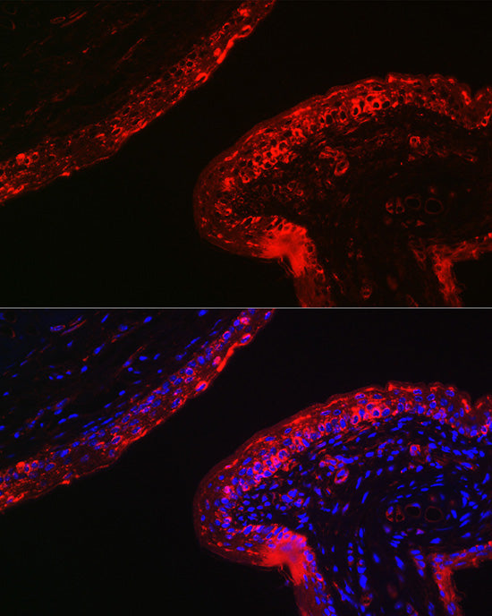 Cytokeratin 16 (KRT16) Rabbit pAb