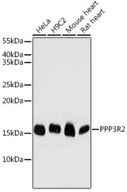 PPP3R2 Rabbit pAb