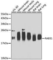 RAB31 Rabbit pAb