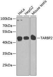 TARBP2 Rabbit pAb