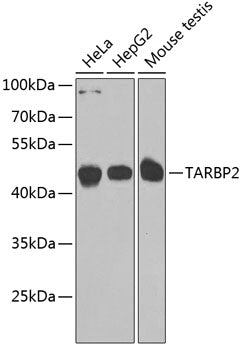 TARBP2 Rabbit pAb