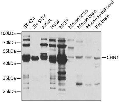 CHN1 Rabbit pAb